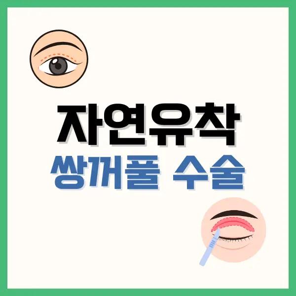 햇살론유스