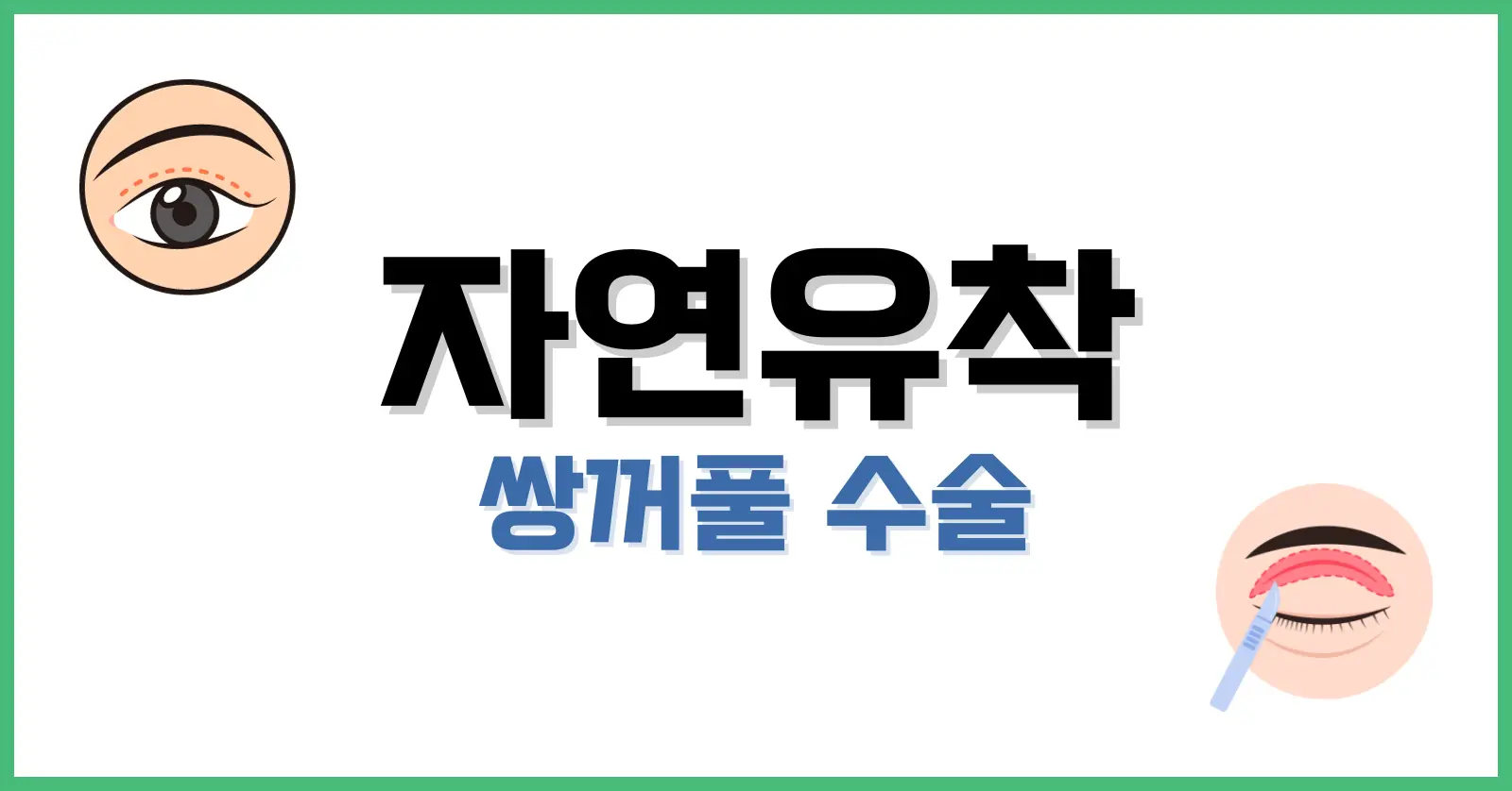 자연유착쌍수